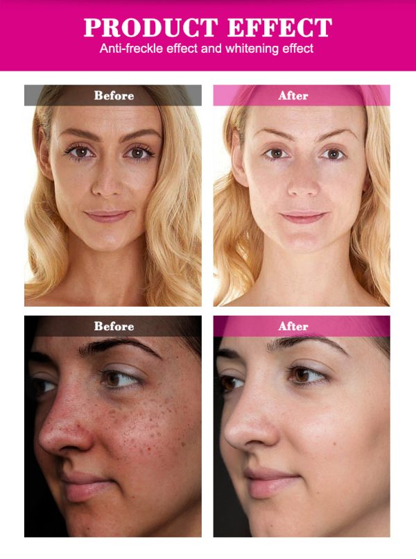 Aichun Beauty Moisturizing Natural Bright Skin Care Whitening Cream  | Best Cream For All Types Of Skin | 80ml - Image 9