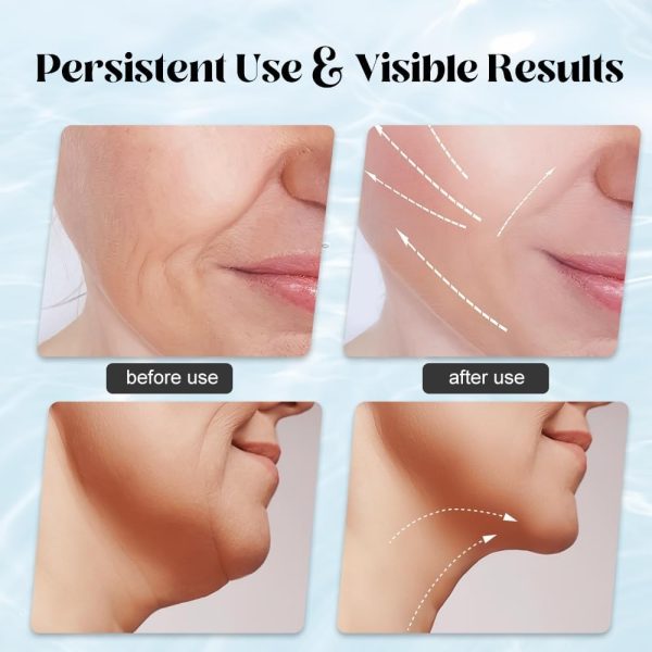 Massager for Face Lifting Facial Massagers EMS Neck Eye Massage Instrument Vibrator Microcurrents Red Light Therapy Anti Wrinkle - Random Color - Image 10