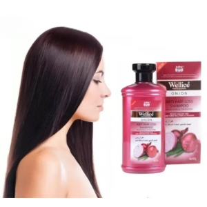 Wellice Professional Onion Anti Hair Loss Shampoo | Onion Shampoo | Shampo | Shampo For Girls & Boys - Anti Hair Loss Shampoo For All Hairs