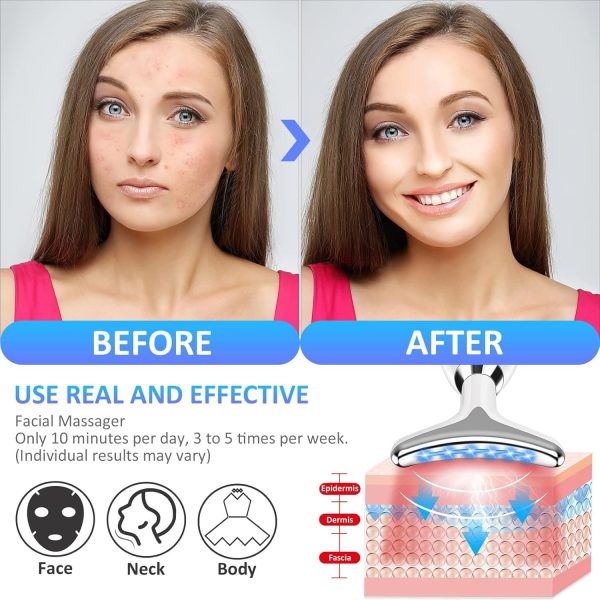 ES-1081 Massager Intense Pulsed Light Wrinkles Reducing Instrument - ESX - Anti Ageing & Reduces Puffiness | Face Massager For Fine Line & Wrinkles - Random Color  - Image 5